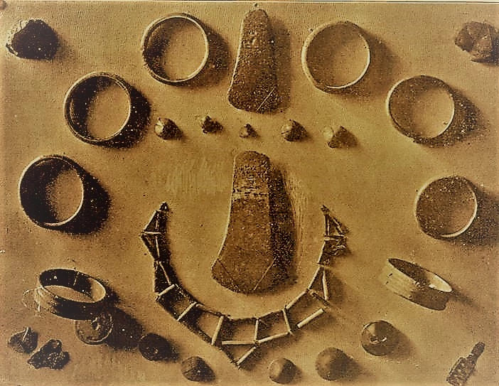 Migdale Hoard